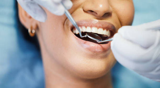 Best Broken or Chipped Tooth Repair in Southwest Greensburg, PA